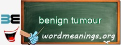 WordMeaning blackboard for benign tumour